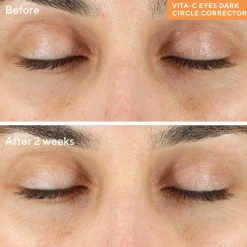 Murad Vita-C Eyes Dark Circle Corrector 15ml