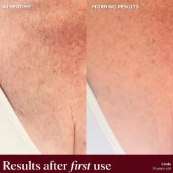 NAYDAYA Chest Wrinkle Shield