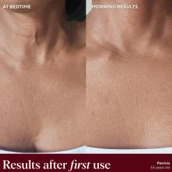 NAYDAYA Chest Wrinkle Shield