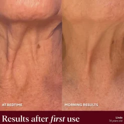 NAYDAYA Neck Wrinkle Shield