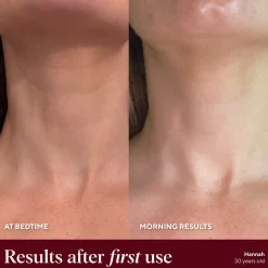 NAYDAYA Neck Wrinkle Shield