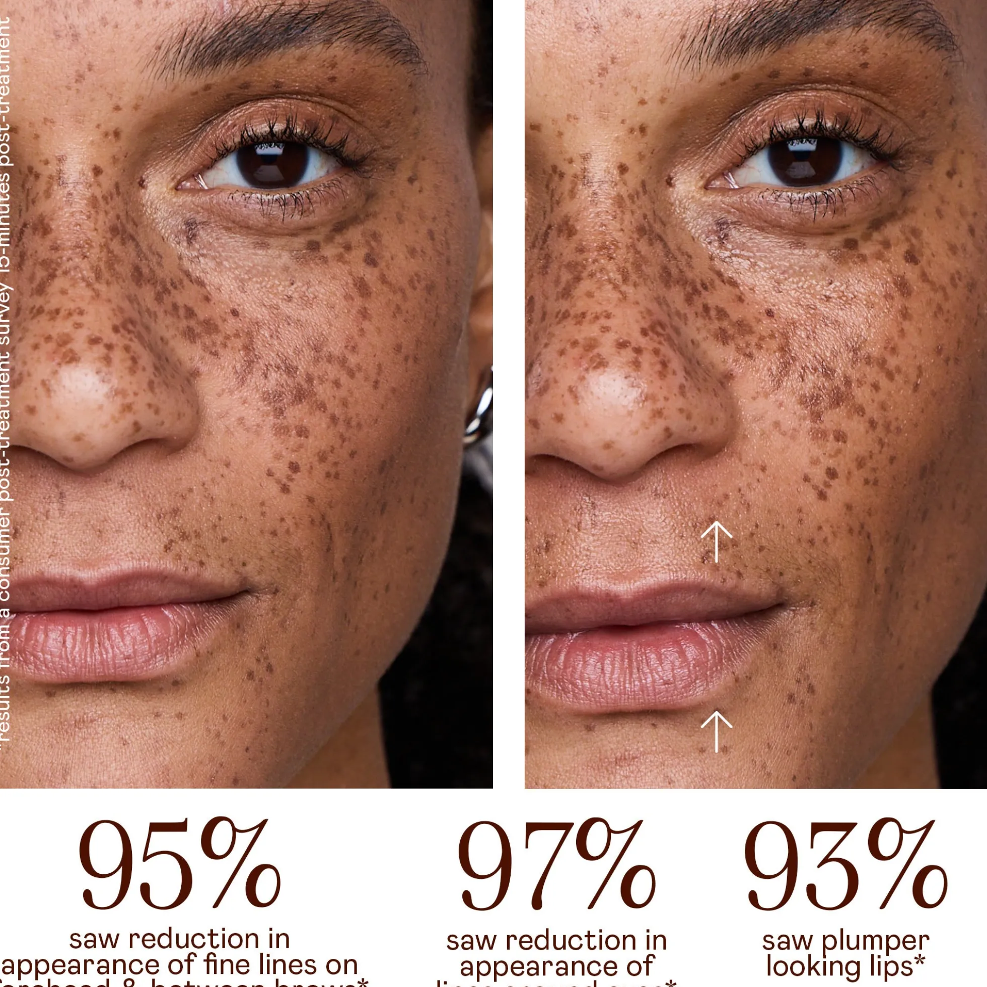 NuFACE FIX Microwand