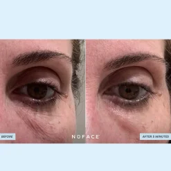 NuFACE Ionplex Hydra-Gel Power Patches