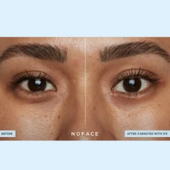 NuFACE Ionplex Hydra-Gel Power Patches