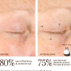 NuFACE Trinity+ and Effective Lip and Eye Attachment Set