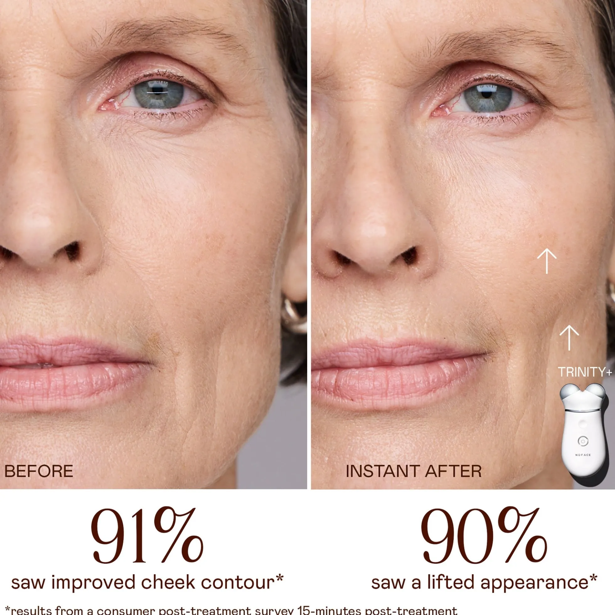 NuFACE Trinity+ Starter Kit - White
