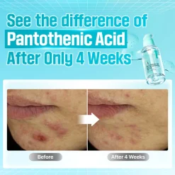 Numbuzin No.1 Pantothenic B5 Active Soothing Serum 50ml