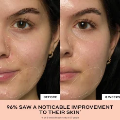 Ole Henriksen Clinical Skin Treats