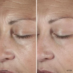 Omorovicza Queen Serum 30ml