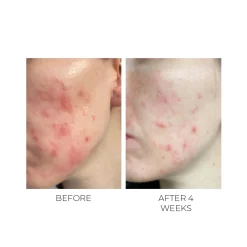 Oskia Violet Water Bha Clarifying Treatment Tonic 100ml