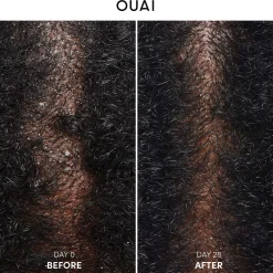 OUAI Anti-Dandruff Shampoo 300ml