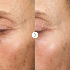 Pai Fade Forward Dark Spot Serum 30ml