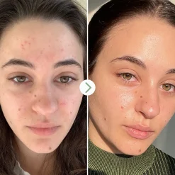 Pai Skincare Carbon Star Detoxifying Overnight Face Oil 30ml