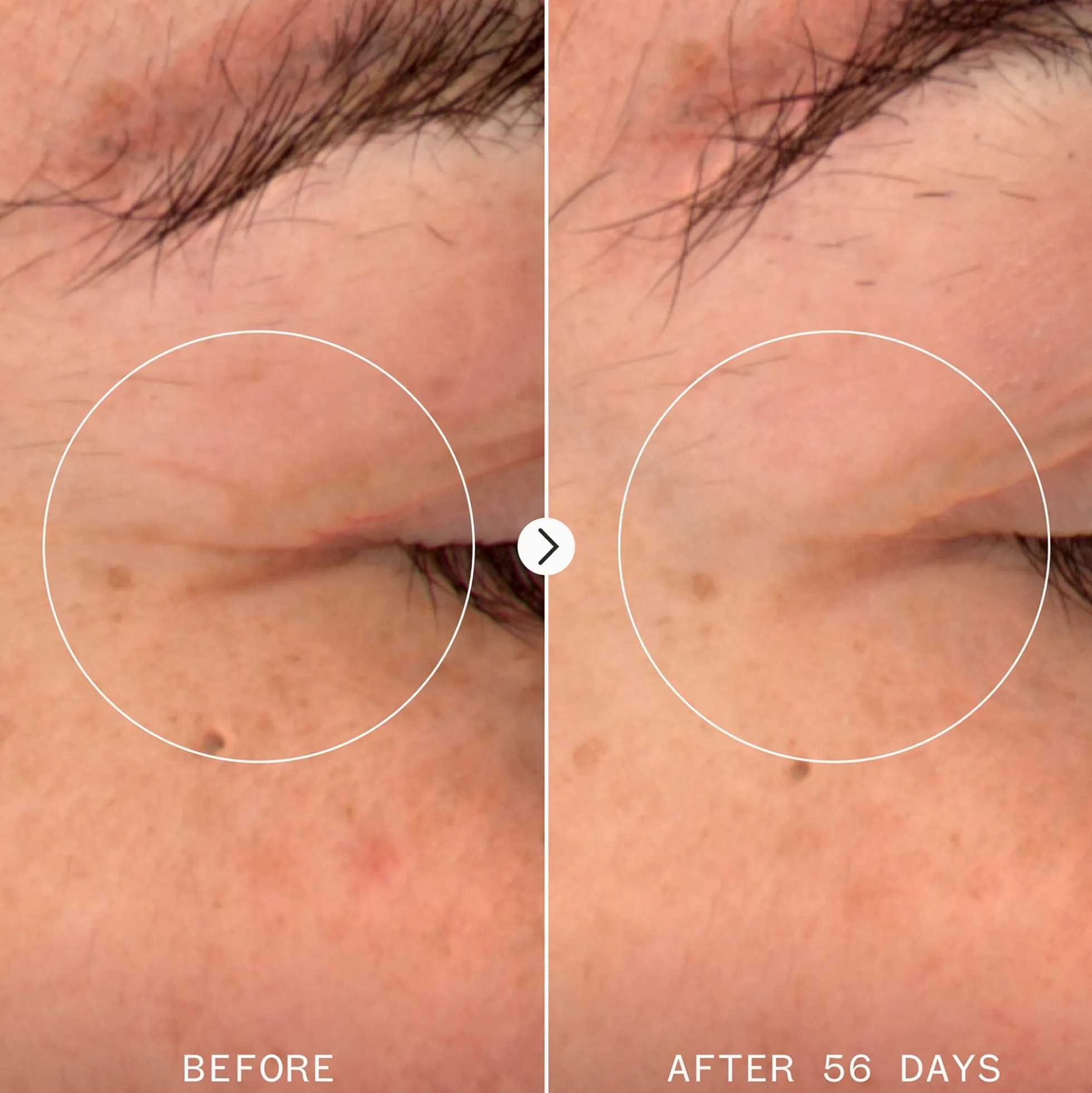 Pai Skincare NAD+ & TriPeptide Renewal Serum 30ml