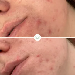 Pai Skincare Phaze Rebalancing PHA Cleanser 100ml