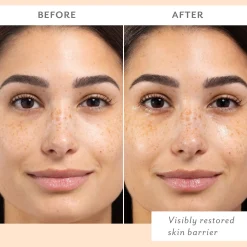 Patchology Skin Remedy Barrier-Boosting Sheet Mask - Single