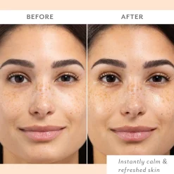 Patchology Skin Remedy Calm & Protect Mist