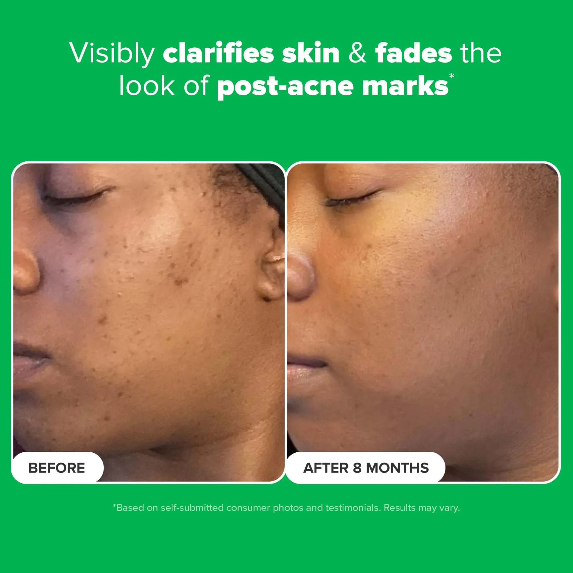 Paula's Choice 10% Azelaic Acid Booster 30ml