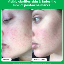 Paula's Choice 10% Azelaic Acid Booster 30ml