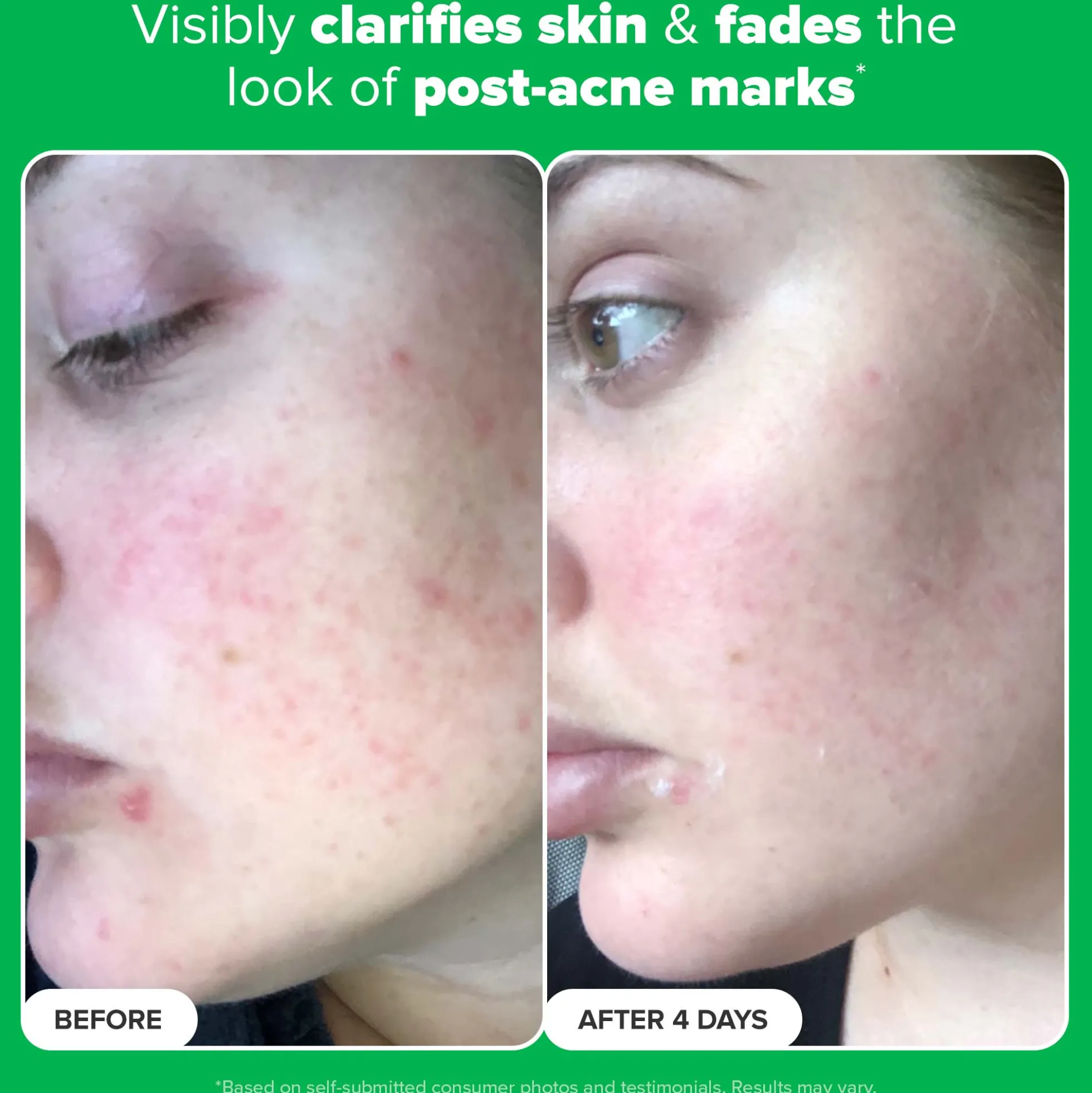 Paula's Choice 10% Azelaic Acid Booster 30ml