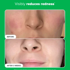 Paula's Choice 10% Azelaic Acid Booster 30ml