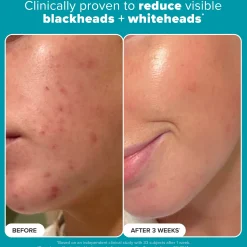 Paula's Choice 2% BHA Exfoliating Toner Pads