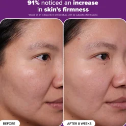 Paula's Choice Clinical 1% Retinol Treatment (30ml)