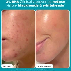 Paula's Choice Multi-Level Exfoliation Trial Kit (Worth £27.00)