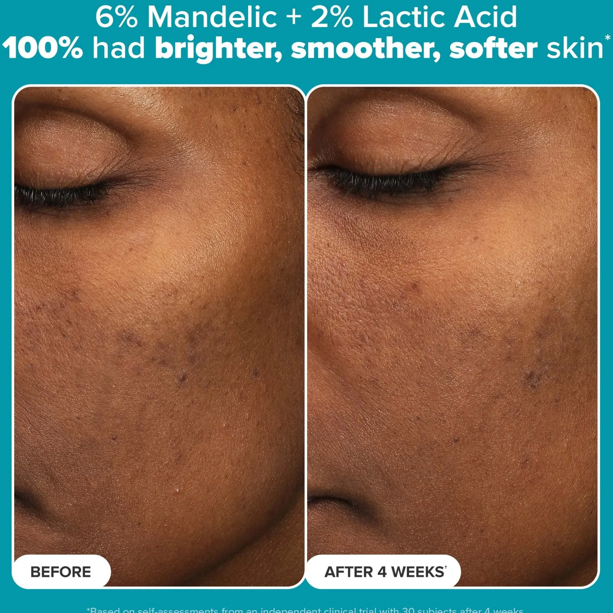 Paula's Choice Multi-Level Exfoliation Trial Kit (Worth £27.00)