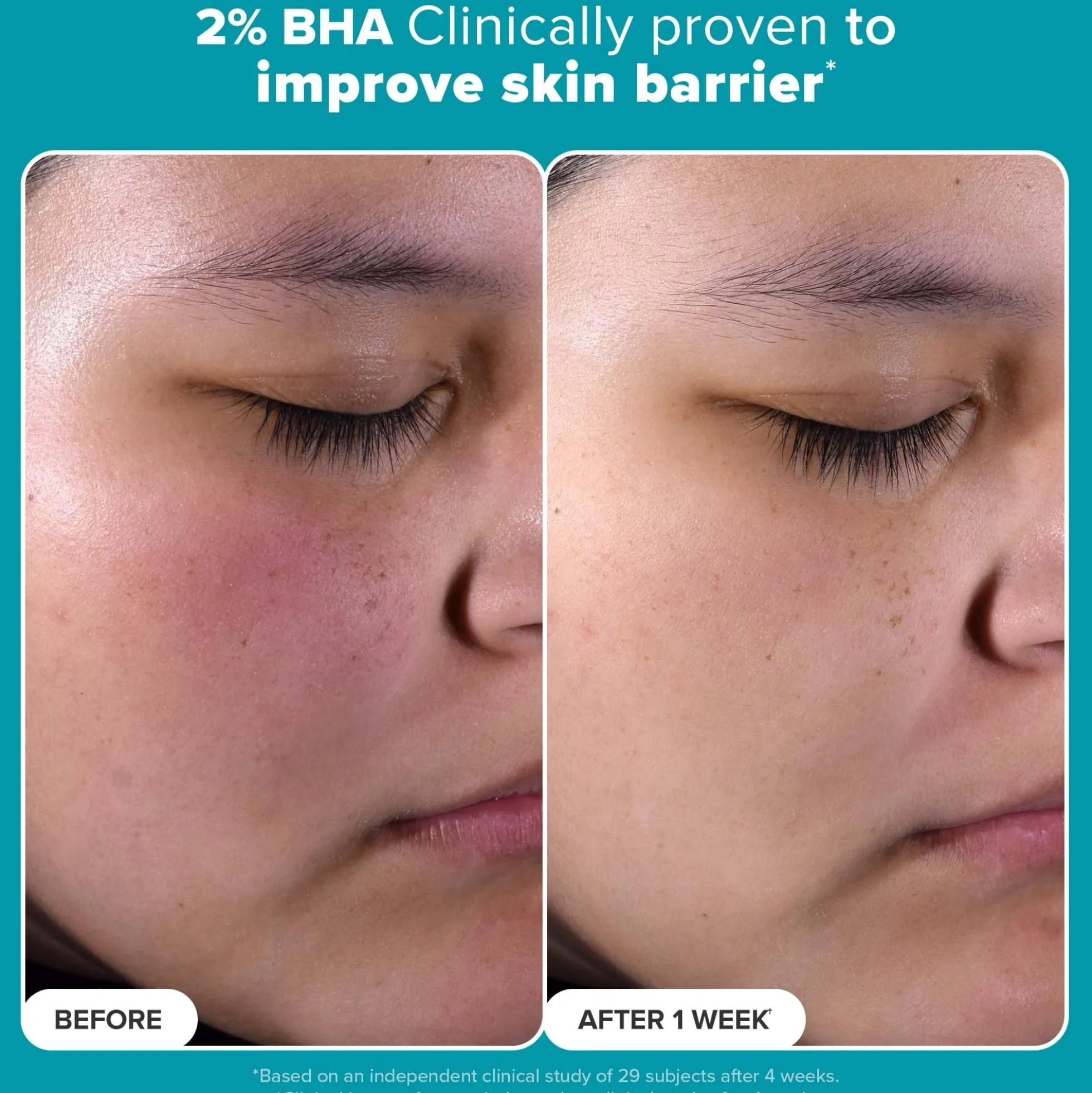 Paula's Choice Multi-Level Exfoliation Trial Kit (Worth £27.00)