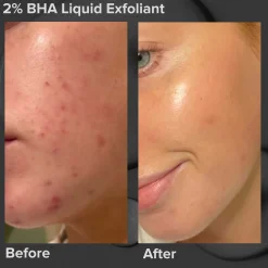 Paula's Choice Multi-Level Exfoliation Set