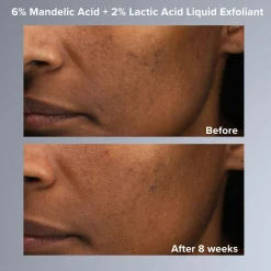 Paula's Choice Multi-Level Exfoliation Set