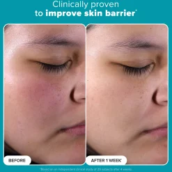 Paulas Choice Skin Perfecting 2% BHA Exfoliating Toner 118ml