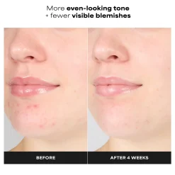 Paula's Choice Skin Perfecting 1% BHA Gentle Exfoliating Gel Toner 100ml