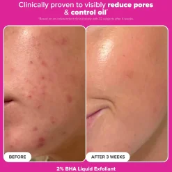 Paula's Choice The Plump & Glow Kit (Worth £32.00)