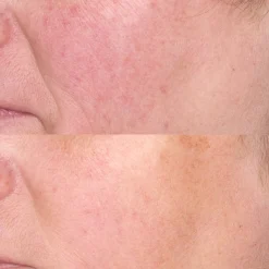 Perricone MD HP Face Finishing and Firming Moisturizer Broad Spectrum SPF 30 2oz FG