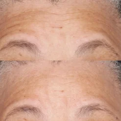 Perricone MD Hypo Clean Correction Barrier Repair Nourishing Moisturizer 2oz FG