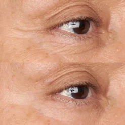 Perricone MD Hypo Clean Correction Firming & Brightening Eye Cream 0.5oz FG