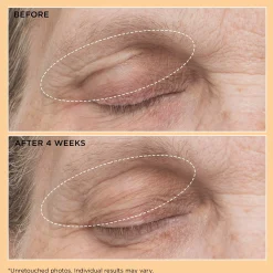 Perricone MD Neuropeptide Eyelid Lift Serum 0.5oz FG