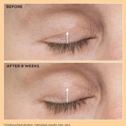 Perricone MD Neuropeptide Eyelid Lift Serum 0.5oz FG