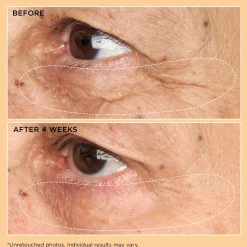 Perricone MD Neuropeptide Eye Cream 15ml