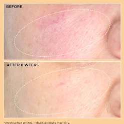 Perricone MD Neuropeptide Moisturizer 59ml