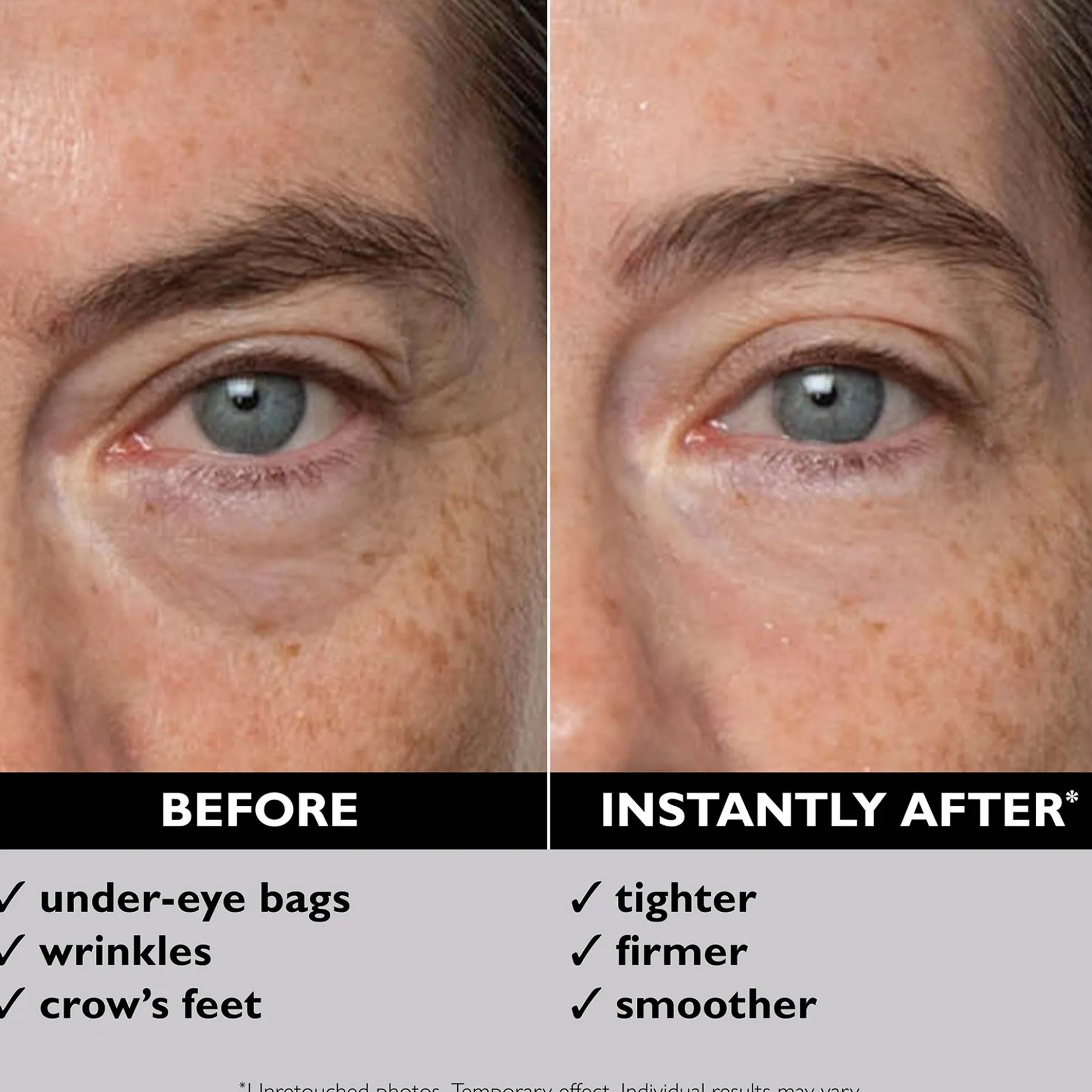 Peter Thomas Roth FIRMx Eye Duo Set