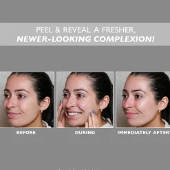 Peter Thomas Roth FIRMx Peeling Gel 100ml