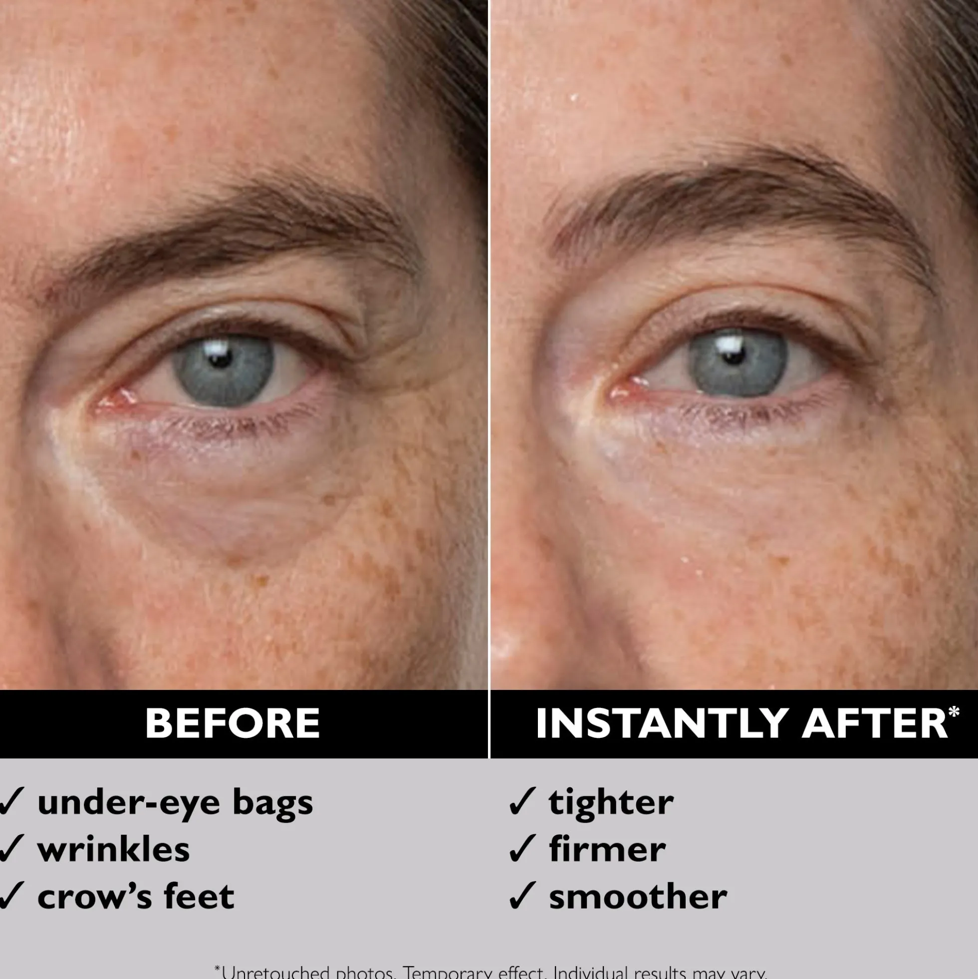 Peter Thomas Roth Instant FIRMx Eye Temporary Eye Tightener 15ml