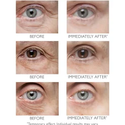 Peter Thomas Roth Instant FIRMx Eye Temporary Eye Tightener 15ml