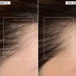 Philip Kingsley Density Preserving Scalp Drops 85ml