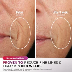 Shark Beauty CryoGlow Under-Eye Cooling & LED Anti-Ageing & Blemish Repair Mask - Lilac Chill