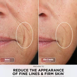 Shark Beauty CryoGlow Under-Eye Cooling & LED Anti-Ageing & Blemish Repair Mask - Pink