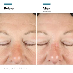 SkinCeuticals A.G.E. Interrupter Advanced Cream For Mature Skin Types 48ml